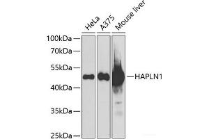 Western blot analysis of extracts of various cell lines using HAPLN1 Polyclonal Antibody at dilution of 1:1000. (HAPLN1 antibody)