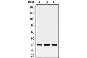 Western blot analysis of FRA2 expression in HeLa (A), MCF7 (B), PC12 (C) whole cell lysates. (FOSL2 antibody  (C-Term))