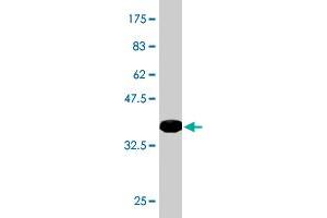 Western Blotting (WB) image for anti-Ceramide Synthase 4 (CERS4) (AA 57-139) antibody (ABIN566360)