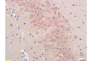 Formalin-fixed and paraffin embedded rat brain labeled with Anti-Phospho-Mcl1 (Ser159/Thr163) Polyclonal Antibody, Unconjugated (ABIN743738) at 1:200, followed by conjugation to the secondary antibody and DAB staining (MCL-1 antibody  (pSer159, pThr163))