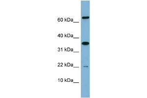 WB Suggested Anti-RWDD1  Antibody Titration: 0. (RWDD1 antibody  (Middle Region))