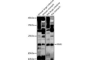 Western blot analysis of extracts of various cell lines, using NMU antibody (ABIN6128376, ABIN6144691, ABIN6144692 and ABIN6222862) at 1:1000 dilution. (Neuromedin U antibody  (AA 35-174))