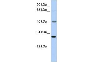 Western Blotting (WB) image for anti-RNA Binding Motif Protein 34 (RBM34) antibody (ABIN2458533) (RBM34 antibody)