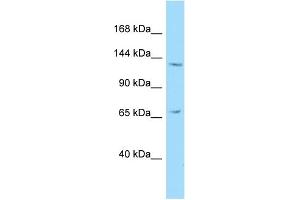 Host: Rabbit Target Name: NEMF Sample Type: HepG2 Whole Cell lysates Antibody Dilution: 1. (NEMF antibody  (C-Term))