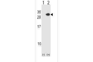 Western blot analysis of RCAN1 (arrow) using rabbit polyclonal RCAN1 Antibody (N-term) (ABIN1539360 and ABIN2848483). (RCAN1 antibody  (N-Term))