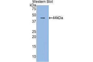 Western blot analysis of the recombinant protein. (Cathelicidin antibody  (AA 30-175))