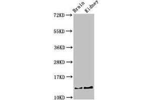 Western Blot Positive WB detected in: Mouse brain tissue, Mouse kidney tissue All lanes: PVALB antibody at 3 μg/mL Secondary Goat polyclonal to rabbit IgG at 1/50000 dilution Predicted band size: 13 kDa Observed band size: 13 kDa (PVALB antibody  (AA 2-110))