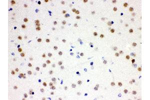 Immunohistochemistry (IHC) image for anti-Cell Division Cycle 25 Homolog B (S. Pombe) (CDC25B) (AA 119-248) antibody (ABIN3043807)