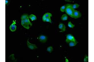 Immunofluorescence staining of MCF-7 cells with ABIN7142217 at 1:266, counter-stained with DAPI.