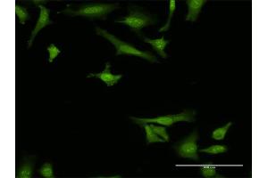Immunofluorescence of monoclonal antibody to ARMET on HeLa cell. (MANF antibody  (AA 116-185))