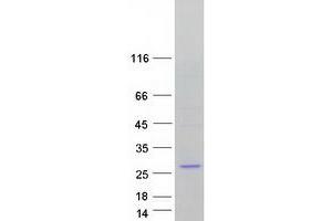 DCTN3 Protein (Transcript Variant 1) (Myc-DYKDDDDK Tag)