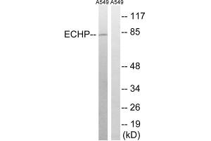 Western blot analysis of extracts from A549 cells, using EHHADH antibody. (EHHADH antibody  (Internal Region))