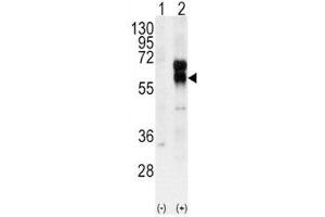 Western blot analysis of ALK1 antibody and 293 cell lysate (2 ug/lane) either nontransfected (Lane 1) or transiently transfected with the ACVRL1 gene (2). (ACVRL1 antibody  (AA 38-68))
