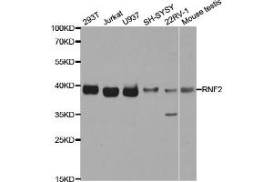 Western blot analysis of extracts of various cell lines, using RNF2 antibody. (RNF2 antibody)