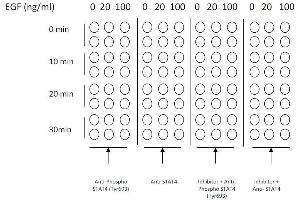 Image no. 4 for Signal Transducer and Activator of Transcription 4 (STAT4) ELISA Kit (ABIN1981841)