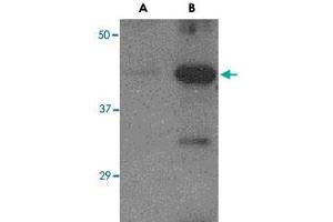 Western blot analysis of (A) 5 ng and (B) 25 ng of recombinant Hemagglutinin with Avian Influenza Hemagglutinin polyclonal antibody  at 1 ug/mL .