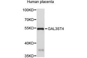 Western blot analysis of extracts of human placenta, using GAL3ST4 antibody (ABIN5972880).