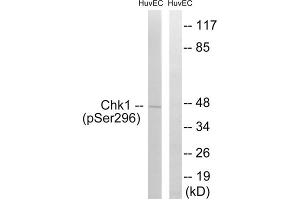 Western blot analysis of extracts from HUVEC cells, treated with UV (15mins), using CHK1 (Phospho-Ser296) antibody. (CHEK1 antibody  (pSer296))