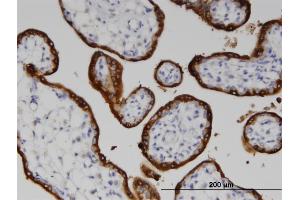 Immunoperoxidase of monoclonal antibody to LSS on formalin-fixed paraffin-embedded human placenta. (LSS antibody  (AA 633-732))