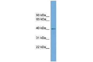 Human HeLa; WB Suggested Anti-ZDHHC18 Antibody Titration: 0. (ZDHHC18 antibody  (Middle Region))