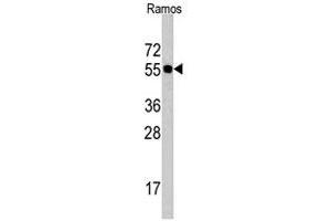Western blot analysis of CDC6 polyclonal antibody  in Ramos cell lysate (35 ug/lane). (CDC6 antibody  (N-Term))
