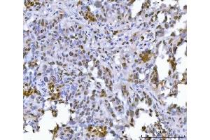 IHC analysis of FIP1L1 using anti-FIP1L1 antibody (ABIN7600761). (FIP1L1 antibody  (AA 23-558))