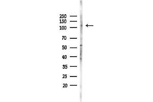 anti-La Ribonucleoprotein Domain Family, Member 1B (LARP1B) (Internal Region) antibody