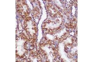 Immunohistochemistry of paraffin-embedded Rat kidney using PIGM Rabbit pAb (ABIN7269294) at dilution of 1:100 (40x lens). (PIGM antibody  (AA 35-96))