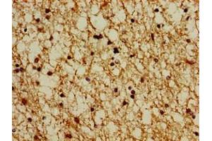 Immunohistochemistry of paraffin-embedded human brain tissue using ABIN7164927 at dilution of 1:100 (PSMG1 antibody  (AA 91-200))