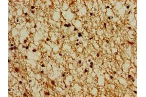 Immunohistochemistry of paraffin-embedded human brain tissue using ABIN7164927 at dilution of 1:100