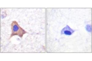 Immunohistochemistry analysis of paraffin-embedded human brain, using CD71/TfR (Phospho-Ser24) Antibody.