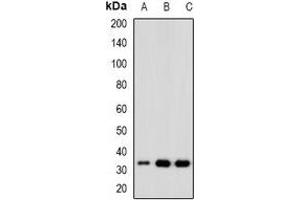 Western blot analysis of CDK6 expression in Hela (A), Jurkat (B), K562 (C) whole cell lysates. (CDK6 antibody)
