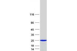 Validation with Western Blot (HPCAL1 Protein (Transcript Variant 2) (Myc-DYKDDDDK Tag))