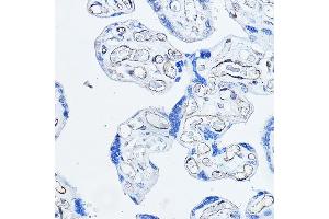 Immunohistochemistry of paraffin-embedded human placenta using CD34 Rabbit pAb (ABIN3021123, ABIN3021124, ABIN3021125, ABIN1512704 and ABIN6213981) at dilution of 1:100 (40x lens). (CD34 antibody  (AA 32-290))