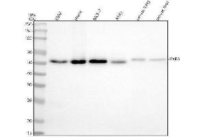 Western blot analysis of Retinoid X Receptor Alpha using anti-Retinoid X Receptor Alpha antibody (ABIN7606170).
