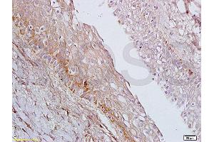 Formalin-fixed and paraffin embedded rat ovary tissue labeled with Anti-AGPAT4 Polyclonal Antibody, Unconjugated (ABIN708671) at 1:200 followed by conjugation to the secondary antibody, (SP-0023), and DAB staining (AGPAT4 antibody  (AA 231-330))