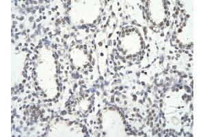 Rabbit Anti-TRIM28 antibody        Paraffin Embedded Tissue:  Human Lung cell   Cellular Data:  Epithelial cells of renal tubule  Antibody Concentration:   4. (KAP1 antibody  (N-Term))