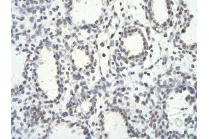 Immunohistochemistry (IHC) image for anti-Tripartite Motif Containing 28 (TRIM28) (N-Term) antibody (ABIN2779797)
