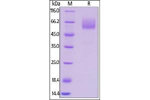 Mouse CD47, Mouse IgG2a Fc Tag, low endotoxin on  under reducing (R) condition. (CD47 Protein (CD47) (AA 19-140) (Fc Tag))