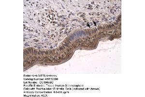 Human Spermatophore (SIRT5 antibody  (C-Term))
