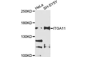 Western blot analysis of extracts of various cell lines, using ITGA11 antibody (ABIN4904088) at 1:1000 dilution.