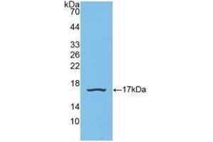 Detection of Recombinant SNRPD1, Human using Polyclonal Antibody to Small Nuclear Ribonucleoprotein Polypeptide D1 (SNRPD1) (SNRPD1 antibody  (AA 1-119))