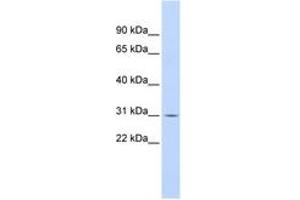 Image no. 1 for anti-Nuclear Factor of kappa Light Polypeptide Gene Enhancer in B-Cells Inhibitor, alpha (NFKBIA) (N-Term) antibody (ABIN6744336) (NFKBIA antibody  (N-Term))