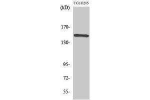 Western Blotting (WB) image for anti-RAD50 Homolog (S. Cerevisiae) (RAD50) (Internal Region) antibody (ABIN3177104) (RAD50 antibody  (Internal Region))
