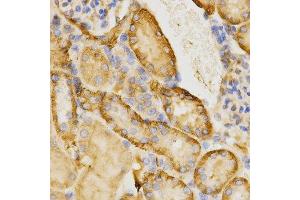 Immunohistochemistry of paraffin-embedded mouse kidney using CDC42 antibody at dilution of 1:200 (x400 lens) (CDC42 antibody)