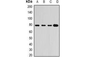 Western blot analysis of GRP3 expression in BT474 (A), A549 (B), mouse heart (C), mouse lung (D) whole cell lysates. (RASGRP3 antibody)