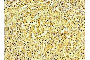 Immunohistochemistry of paraffin-embedded human spleen tissue using ABIN7145839 at dilution of 1:100 (KCTD15 antibody  (AA 1-234))