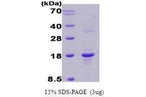 Figure annotation denotes ug of protein loaded and % gel used. (RCAN1 Protein (AA 1-117, Isoform B))
