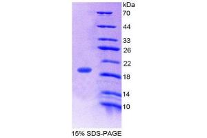 SDS-PAGE (SDS) image for Gastric Inhibitory Polypeptide (GIP) (AA 22-153) protein (His tag) (ABIN2124924)