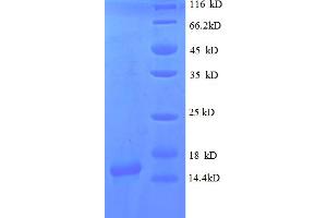 SDS-PAGE (SDS) image for gamma-Interferon-Induced Monokine (CXCL9) (AA 22-126) protein (His tag) (ABIN4974928) (CXCL9 Protein (AA 22-126) (His tag))